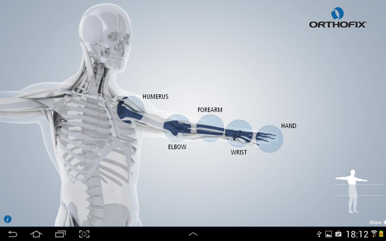 Orthofix ABS