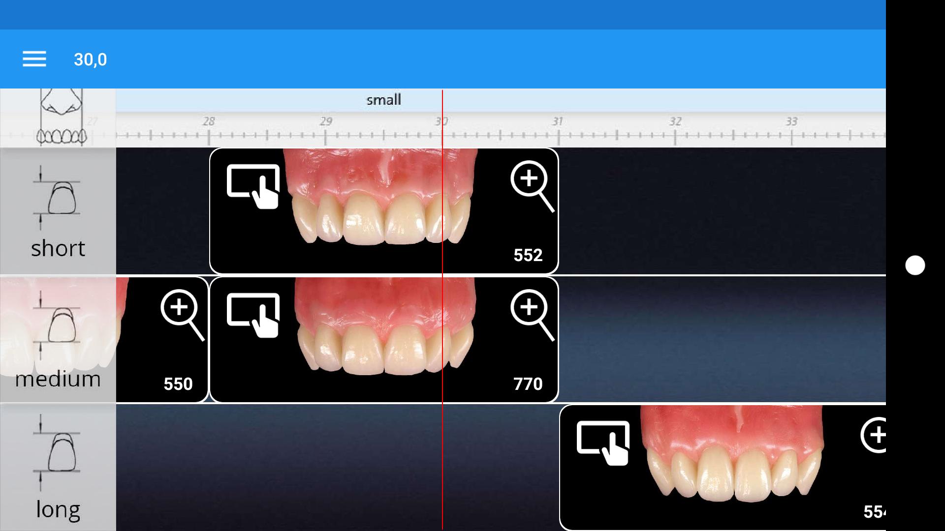Candulor ToothScout
