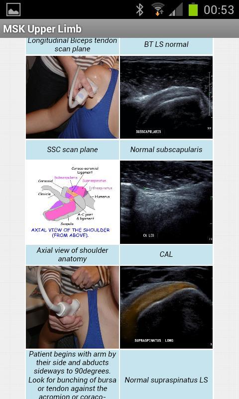 MSK ultrasound upper limb Lite