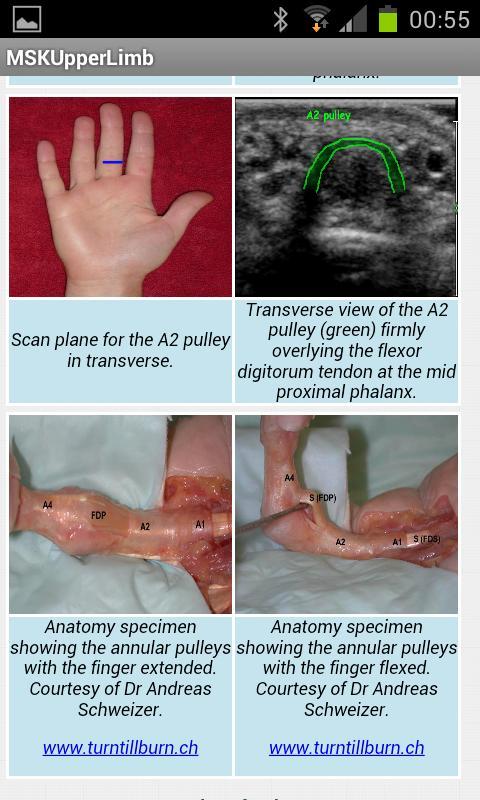 MSK ultrasound upper limb Lite