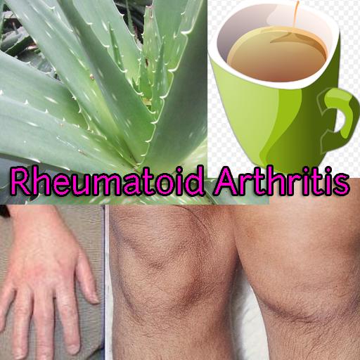 Rheumatoid Arthritis