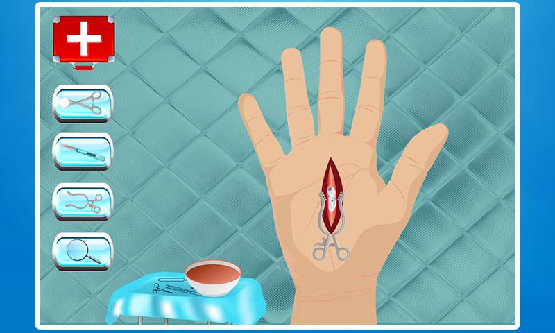 Palm Surgery