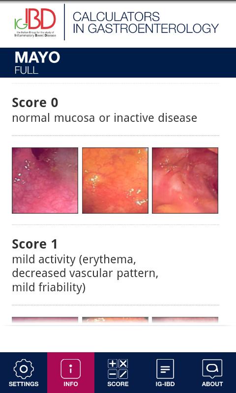 IGIBD Scores
