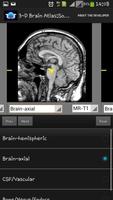 3-D brain Atlas