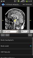 3-D brain Atlas