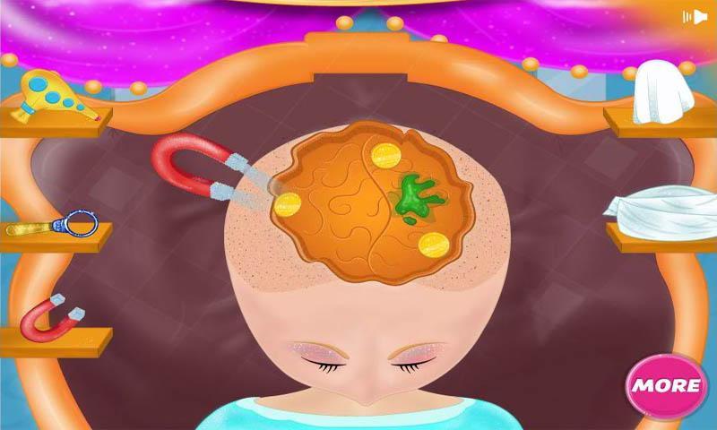Brain Surgery